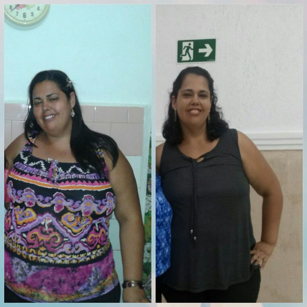Antes e Depois 1